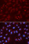 X-Ray Repair Cross Complementing 3 antibody, A01068, Boster Biological Technology, Western Blot image 