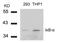 NFKB Inhibitor Alpha antibody, GTX50510, GeneTex, Western Blot image 