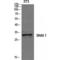 Snail Family Transcriptional Repressor 1 antibody, LS-C386128, Lifespan Biosciences, Western Blot image 