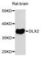 Distal-Less Homeobox 2 antibody, STJ110708, St John