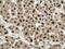 Enolase-Phosphatase 1 antibody, 17731-1-AP, Proteintech Group, Immunohistochemistry paraffin image 