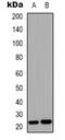 Fibroblast Growth Factor 9 antibody, abx133760, Abbexa, Western Blot image 