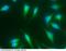 Bone Morphogenetic Protein 2 antibody, 10426-MM22, Sino Biological, Immunohistochemistry paraffin image 