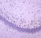 WW Domain Containing Oxidoreductase antibody, A01223-1, Boster Biological Technology, Immunohistochemistry paraffin image 