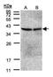 Protein Phosphatase 2 Catalytic Subunit Beta antibody, PA5-27483, Invitrogen Antibodies, Western Blot image 