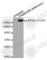 Eukaryotic Translation Initiation Factor 4 Gamma 1 antibody, AP0279, ABclonal Technology, Western Blot image 