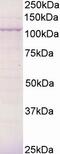 BCAR3 Adaptor Protein, NSP Family Member antibody, 45-324, ProSci, Enzyme Linked Immunosorbent Assay image 