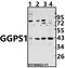 Geranylgeranyl Diphosphate Synthase 1 antibody, A06524, Boster Biological Technology, Western Blot image 