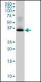 Glycogenin 1 antibody, orb89607, Biorbyt, Western Blot image 