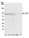 LTV1 Ribosome Biogenesis Factor antibody, A304-950A, Bethyl Labs, Western Blot image 