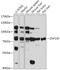Zinc Finger Protein 143 antibody, 16-983, ProSci, Western Blot image 