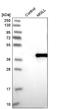 Monoglyceride Lipase antibody, NBP1-89646, Novus Biologicals, Western Blot image 