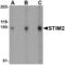 Stromal interaction molecule 2 antibody, AHP1429, Bio-Rad (formerly AbD Serotec) , Western Blot image 