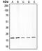 Claudin 4 antibody, LS-B16511, Lifespan Biosciences, Western Blot image 