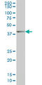 Distal-Less Homeobox 2 antibody, LS-B5398, Lifespan Biosciences, Western Blot image 