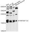 TNF Receptor Superfamily Member 13C antibody, LS-C749304, Lifespan Biosciences, Western Blot image 