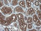 Ras Homolog Family Member J antibody, LS-C337900, Lifespan Biosciences, Immunohistochemistry paraffin image 