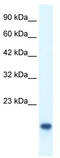 MYC Binding Protein antibody, TA329427, Origene, Western Blot image 