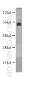 Origin Recognition Complex Subunit 5 antibody, 11542-1-AP, Proteintech Group, Western Blot image 