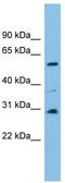 Dihydrouridine Synthase 1 Like antibody, TA344691, Origene, Western Blot image 