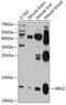 Hemoglobin Subunit Gamma 2 antibody, 14-155, ProSci, Western Blot image 