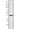 3-keto acyl-CoA synthase ELOVL2 antibody, abx215141, Abbexa, Western Blot image 