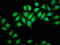 DExH-Box Helicase 34 antibody, LS-C671050, Lifespan Biosciences, Immunofluorescence image 