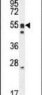 DMRT Like Family A1 antibody, PA5-24343, Invitrogen Antibodies, Western Blot image 