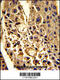 Complement Factor H Related 1 antibody, 62-361, ProSci, Immunohistochemistry paraffin image 