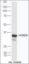 Erb-B2 Receptor Tyrosine Kinase 4 antibody, orb157500, Biorbyt, Western Blot image 