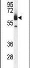 Zinc Finger Containing Ubiquitin Peptidase 1 antibody, PA5-24149, Invitrogen Antibodies, Western Blot image 
