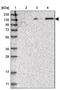 SPOC Domain Containing 1 antibody, NBP1-93922, Novus Biologicals, Western Blot image 