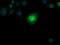 Chaperonin Containing TCP1 Subunit 8 Like 2 antibody, TA505306BM, Origene, Immunofluorescence image 