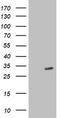 Sirtuin 5 antibody, CF503233, Origene, Western Blot image 