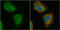 Transgelin antibody, GTX101608, GeneTex, Immunofluorescence image 