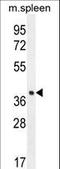 Tetraspan membrane protein of hair cell stereocilia antibody, LS-C165760, Lifespan Biosciences, Western Blot image 