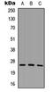 Sodium Channel Modifier 1 antibody, LS-C354473, Lifespan Biosciences, Western Blot image 