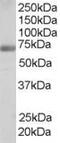 Formin-binding protein 1 antibody, MBS420283, MyBioSource, Western Blot image 