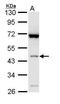SH3 Domain Containing GRB2 Like, Endophilin B1 antibody, GTX113061, GeneTex, Western Blot image 