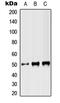 ST3 Beta-Galactoside Alpha-2,3-Sialyltransferase 3 antibody, MBS820709, MyBioSource, Western Blot image 