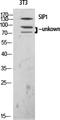 Zinc Finger E-Box Binding Homeobox 2 antibody, A01169-2, Boster Biological Technology, Western Blot image 