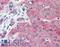 Claudin 1 antibody, LS-B2571, Lifespan Biosciences, Immunohistochemistry paraffin image 