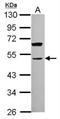 Activin A Receptor Type 1C antibody, NBP2-15272, Novus Biologicals, Western Blot image 