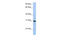 Carbohydrate Sulfotransferase 14 antibody, 30-488, ProSci, Enzyme Linked Immunosorbent Assay image 