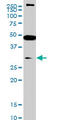 SET Domain Containing 7, Histone Lysine Methyltransferase antibody, LS-B8443, Lifespan Biosciences, Western Blot image 