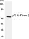 Ribosomal Protein S6 Kinase B2 antibody, LS-C200454, Lifespan Biosciences, Western Blot image 