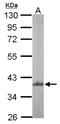 Actin Related Protein 2/3 Complex Subunit 1B antibody, NBP2-15263, Novus Biologicals, Western Blot image 