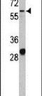 Activated Leukocyte Cell Adhesion Molecule antibody, PA5-12513, Invitrogen Antibodies, Western Blot image 