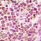 Interferon Regulatory Factor 4 antibody, LS-C354012, Lifespan Biosciences, Immunohistochemistry paraffin image 