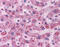 Cyclin D1 antibody, 51-565, ProSci, Immunohistochemistry paraffin image 